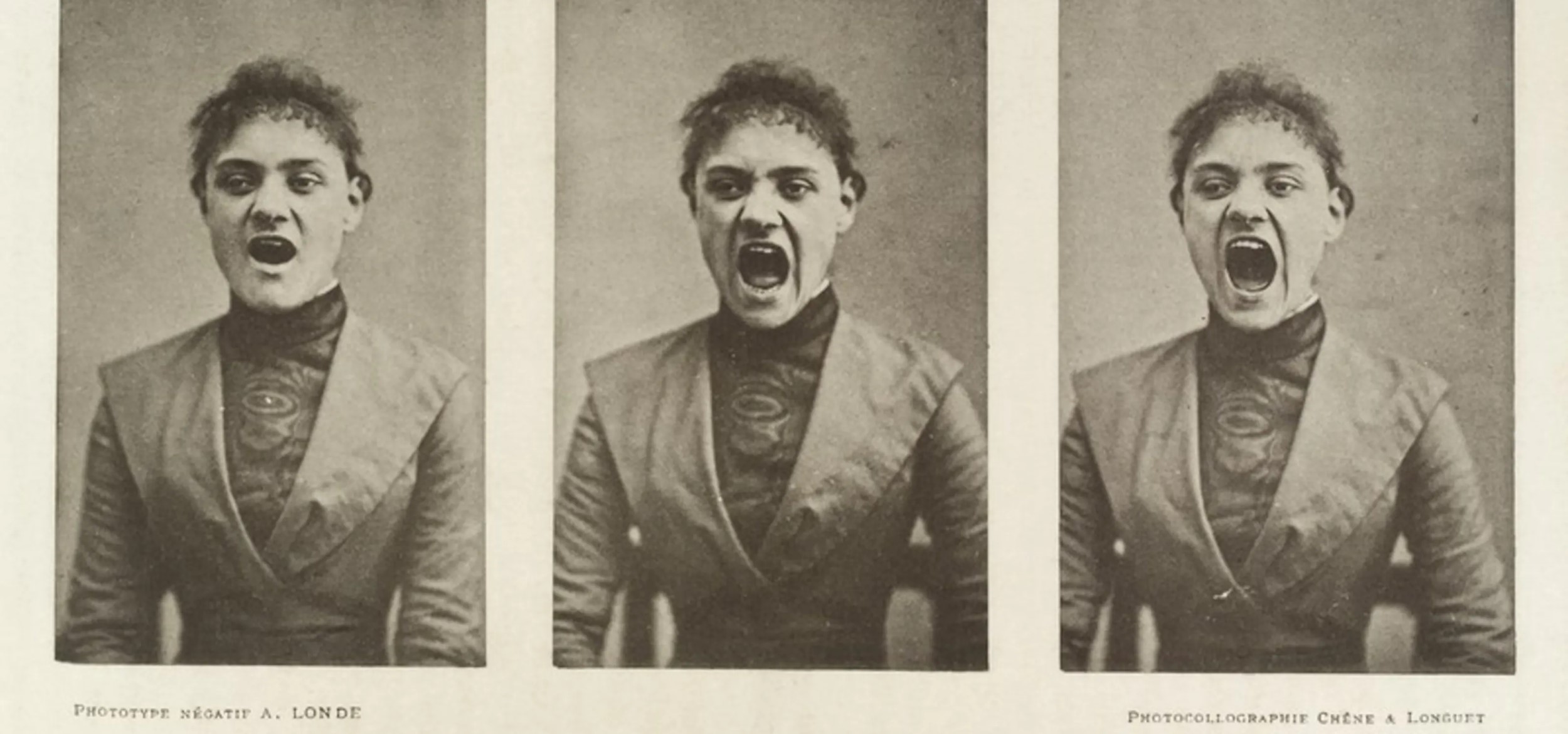 Women , Pain and Hysteria